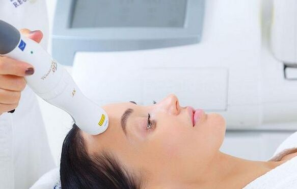skin rejuvenation with a laser device